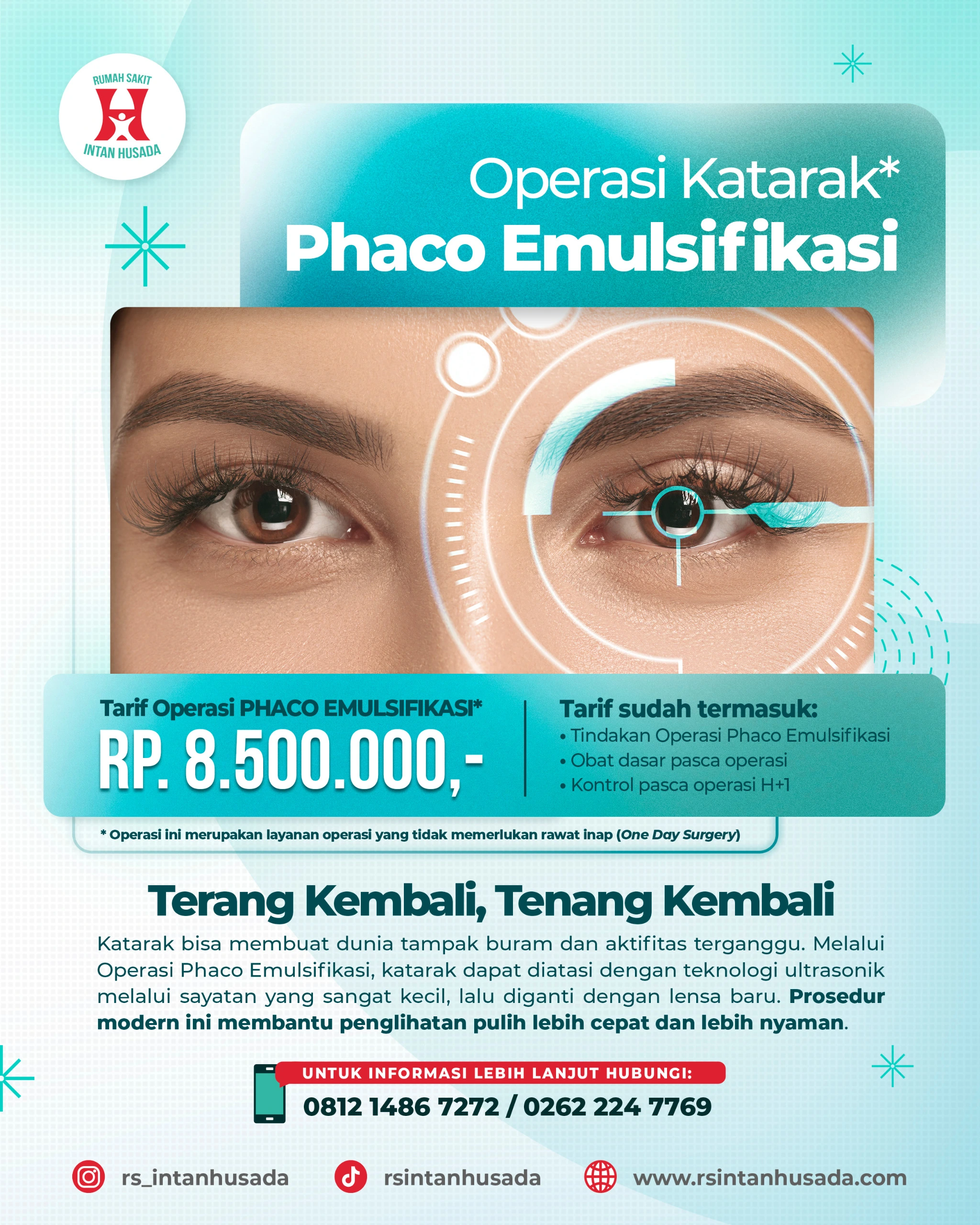Layanan Operasi Katarak Phaco Emulsifikasi RS Intan Husada